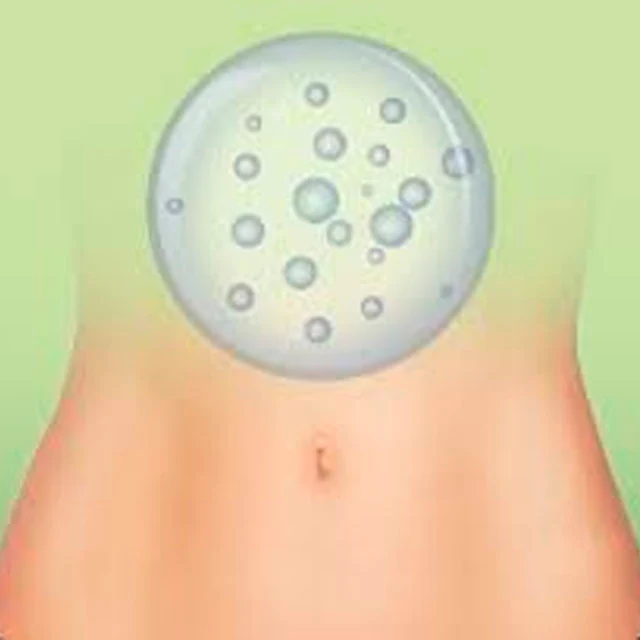 Complemento Alimenticio para la Eliminación de Gases - Image 2